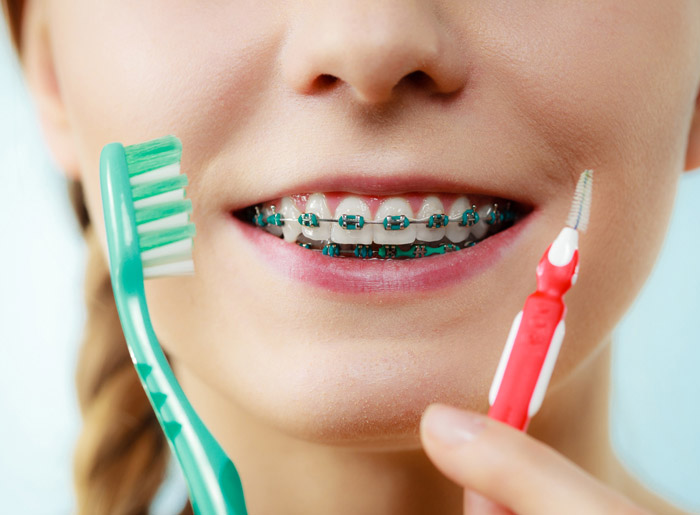 How Do Dentists Clean Your Teeth With Braces?